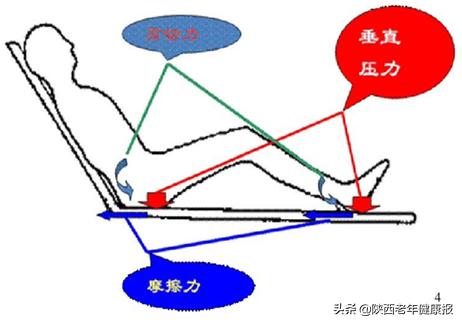 伤口造口小组介绍,伤口造口护理研究综述