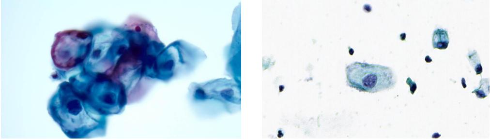 显微镜下的万花世界——走进病理学