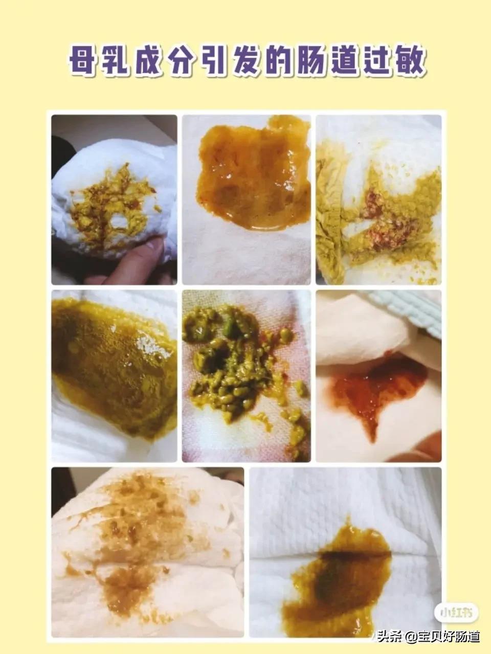 宝宝拉肚子和吃药有没有关系,乱吃治拉肚子的药有什么后果