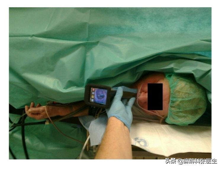 Airtraq氧瞬得，气管插管的最佳解决方案！