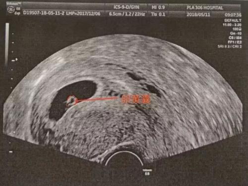 朋友准备怀孕了怎么恭喜她,怎样看是否怀孕