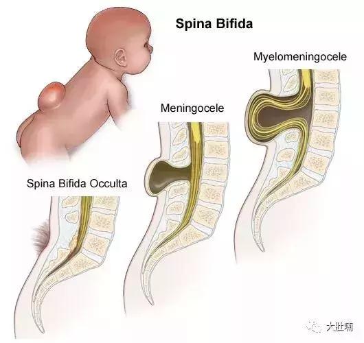 孕妇吃哪个品牌的叶酸最好,孕妇活性叶酸哪个品牌好