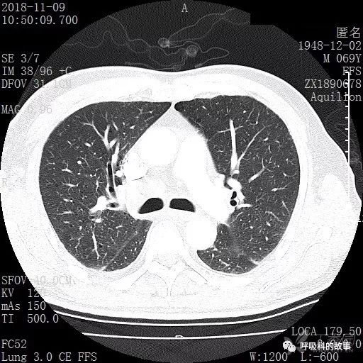 怎么应用统计学做调查,统计学方法可以解决的主要问题
