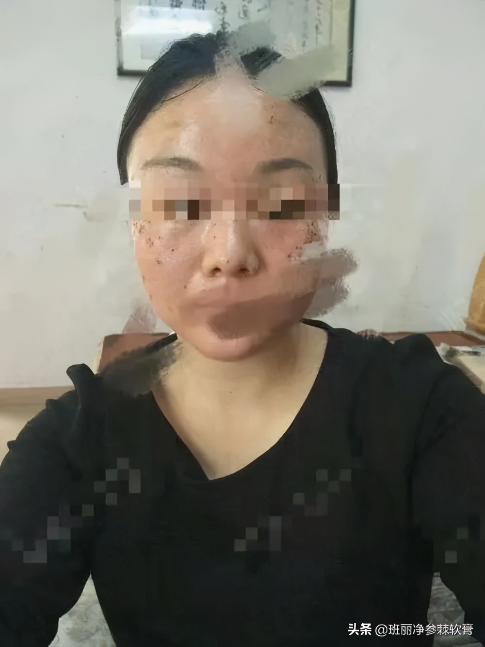 现在很多人都在祛斑靠谱吗,到底祛斑是真的还是假的