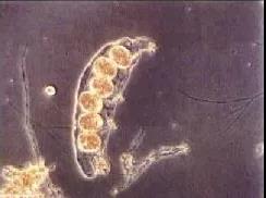 污泥镜检操作方法,污泥检测项目及标准有哪些呢