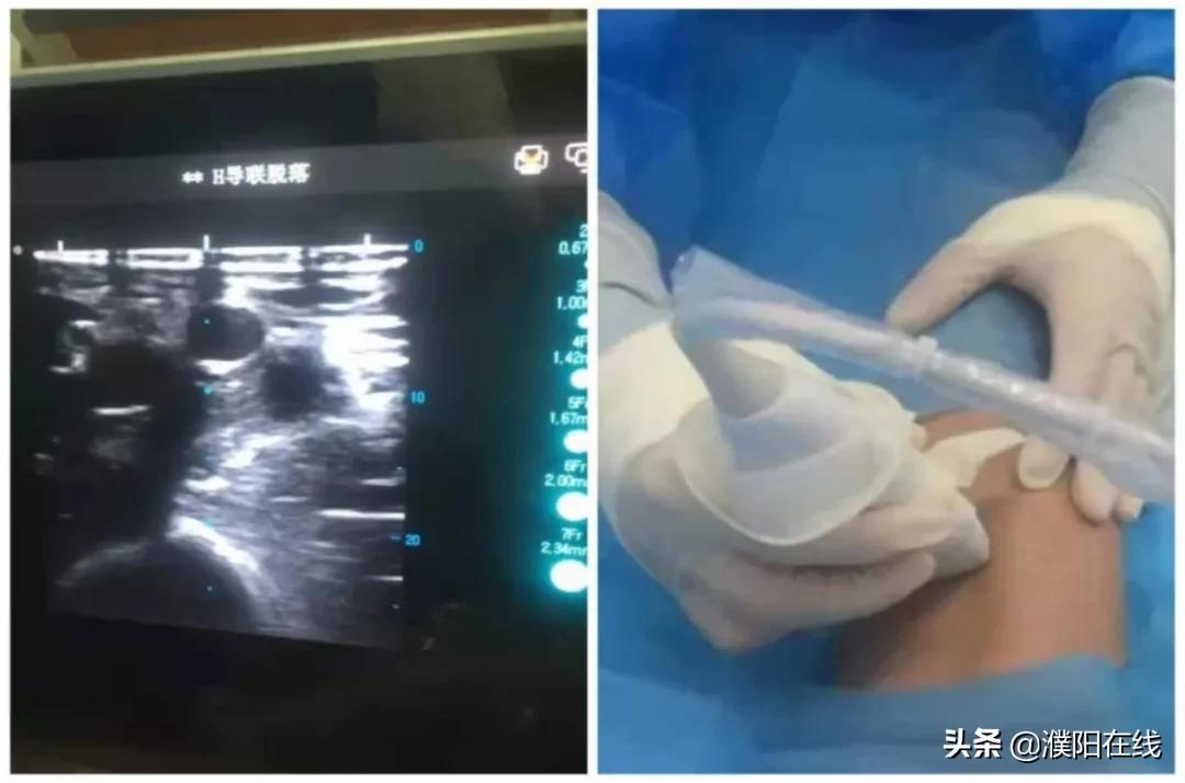 与时间赛跑的医务工作者,与时间赛跑的人中医院