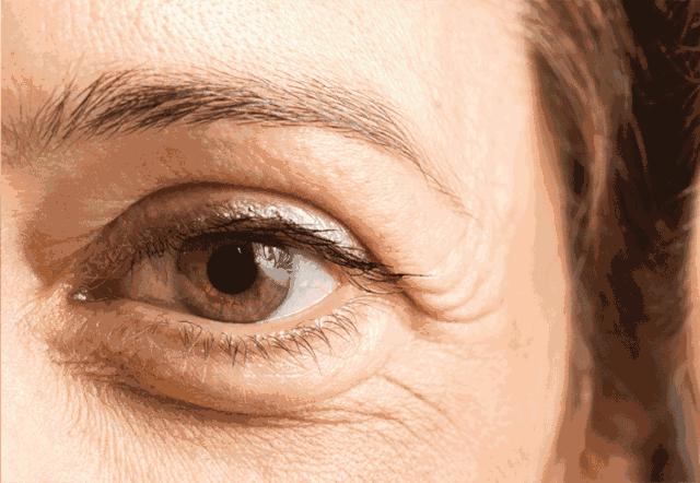 目前国内最有效的除皱方法,有几种长久有效的除皱方法