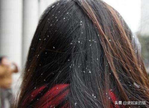 去油去头屑用什么洗发水最好,头屑多头痒用什么洗发水比较好