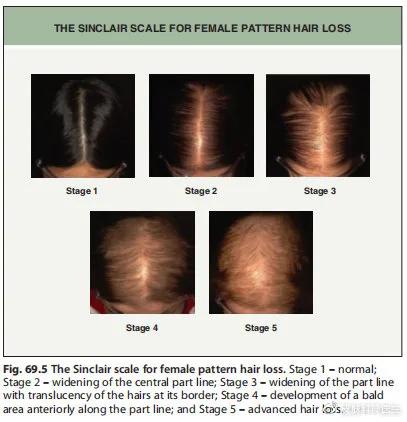 自我剖析问题原因和整改措施,自我诊断原因分析及改进措施