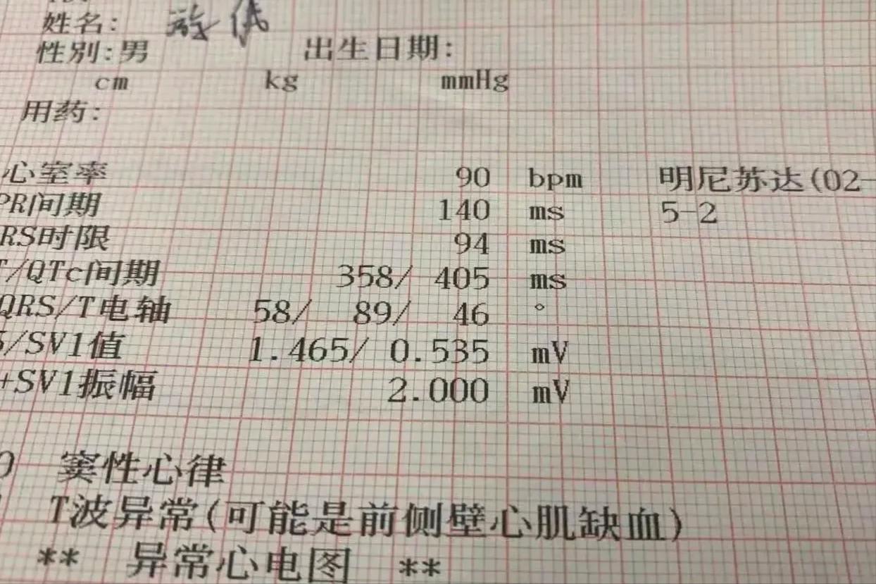 董事长拒绝住院5天后猝死,董事长不听医生劝5天后猝死