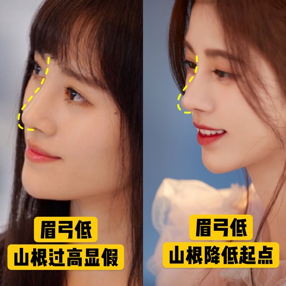 好看的鼻子类型驼峰鼻,好看的鼻型有哪几种