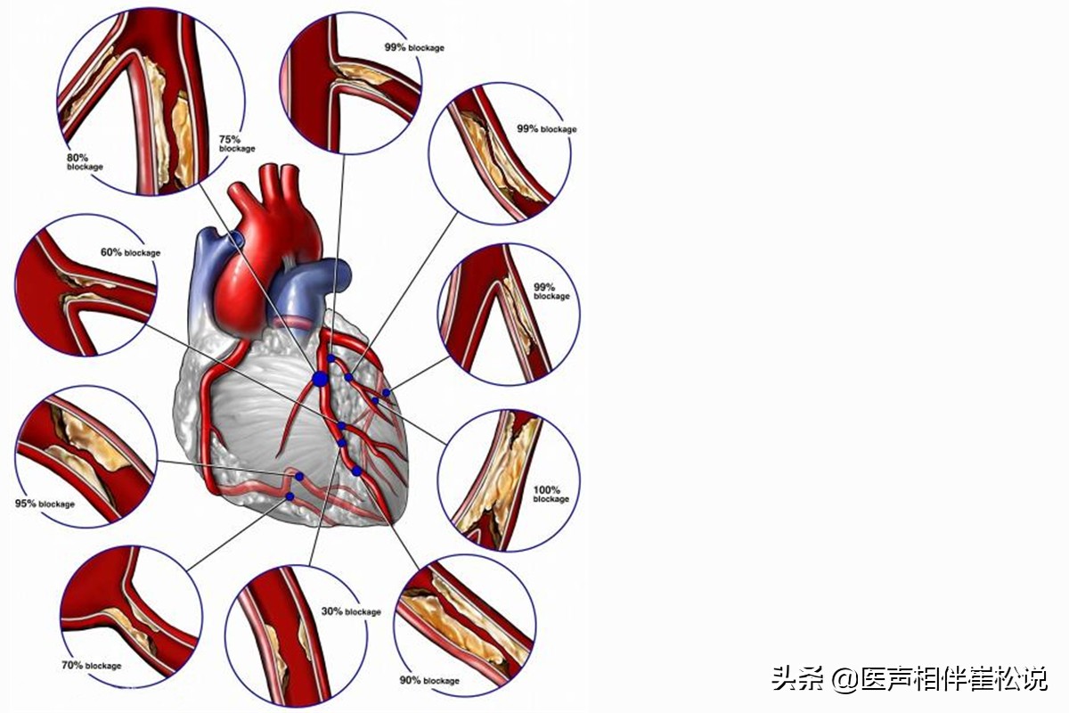 这份心脏说明书请收好,心脏保健手册