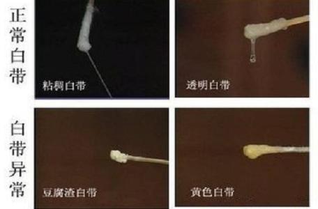 妇科病：白带异常是多种疾病的警示信号，应对方案及调节方法