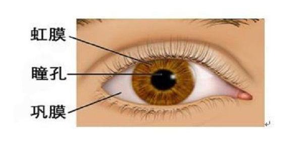 小孩眼白有黑点是啥原因,儿童眼白有黑点是怎么回事