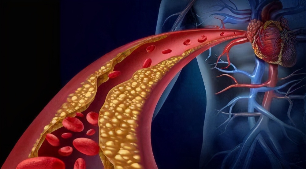 高血压如何不吃药才能降血压,高血压不吃药怎么快速降血压