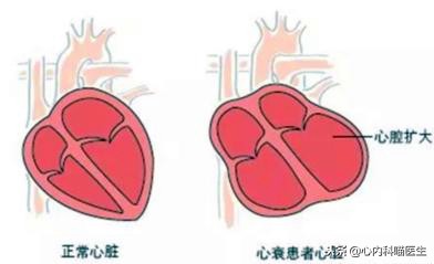抗心衰的最新药物arni,心衰用药方法及用药剂量