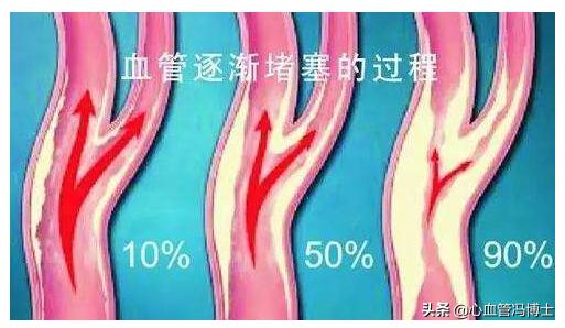 消除斑块的食物食谱,消除斑块最好的水果