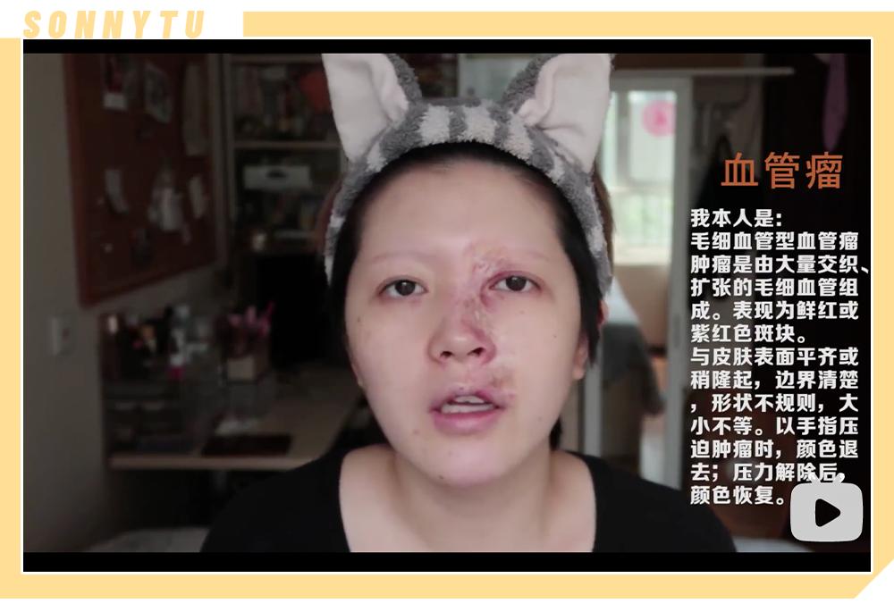 胸大但是胸型不饱满,胸很大但不聚拢正常吗