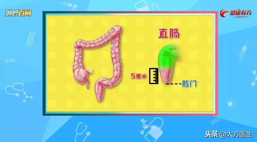 直肠癌大夫说切掉8公分严重吗,得了直肠癌要做手术吗