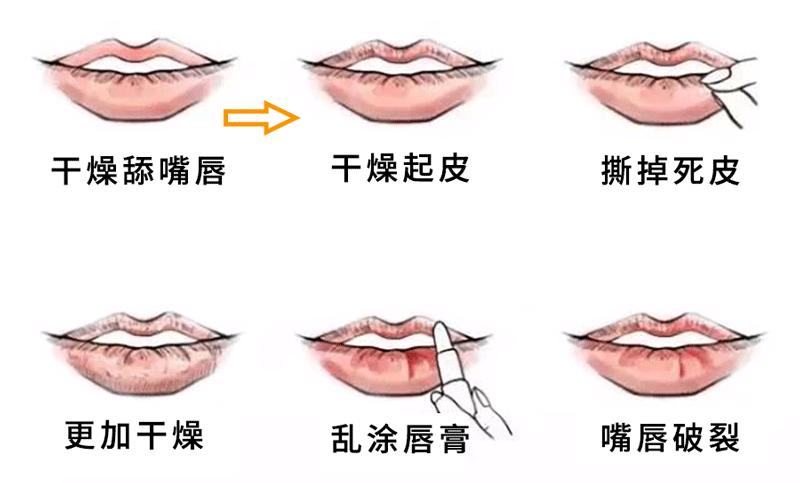 泫雅玻尿酸唇,泫雅水光唇