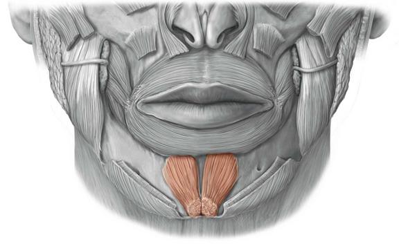 人造酒窝身体的缺陷,人造酒窝全过程