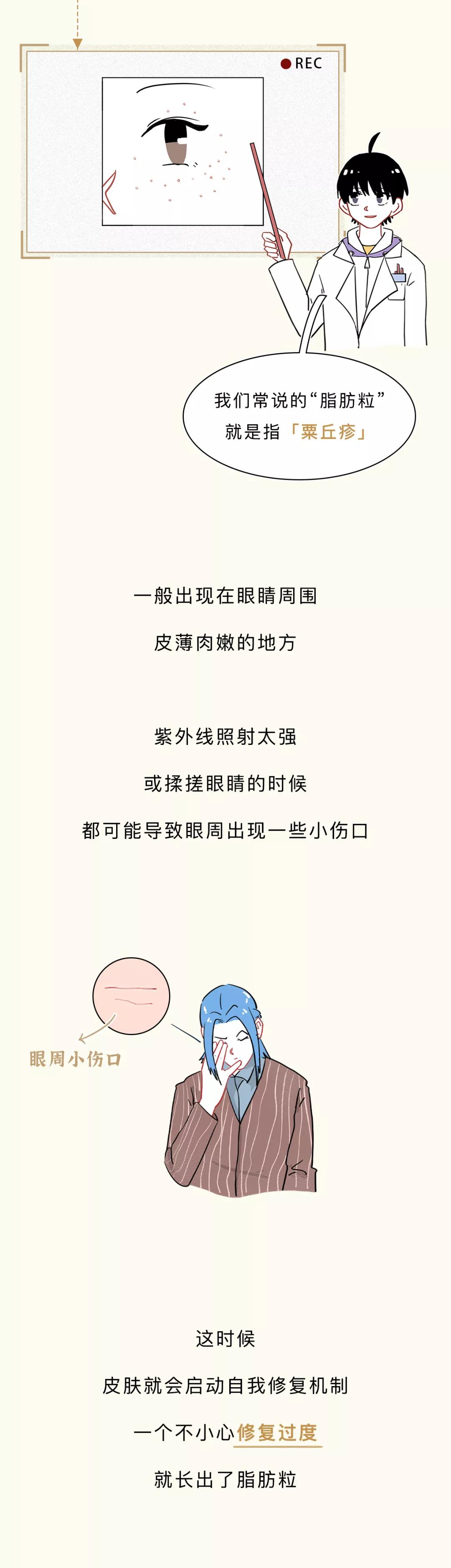 眼睛周围的脂肪粒会传染吗,去眼睛周围脂肪粒最佳方法