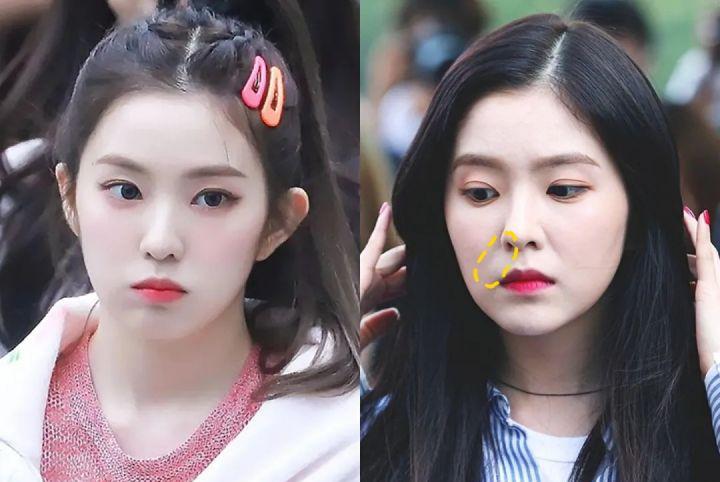 为什么有些人年纪不大，但法令纹却很重？