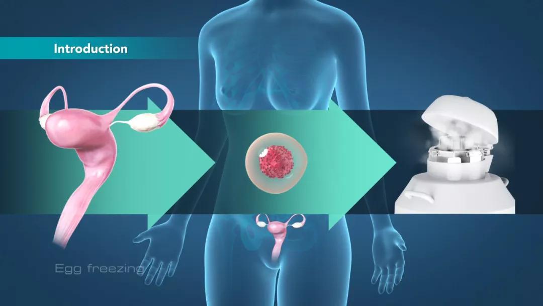 收藏！试管婴儿促排、取卵、移植期间的生活指南