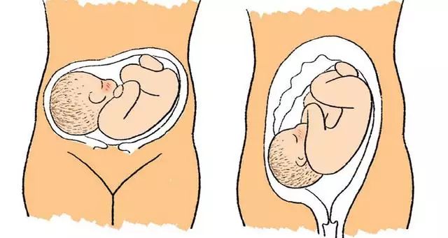 胎儿打嗝是不是代表胎儿健康呢,胎儿为什么会打嗝