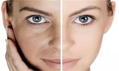 护肤品出现搓泥现象,兰蔻护肤品为什么有搓泥现象