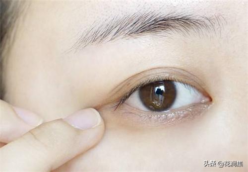 超级黑眼圈眼袋怎么遮,熊猫眼黑眼圈和眼袋区别图片