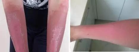 紫外线防晒冰袖,防紫外线最好的防晒袖