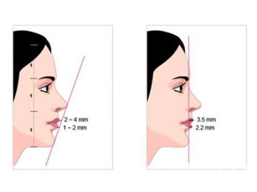 如何拥有好看的下巴,一个标准好看的下巴有多重要