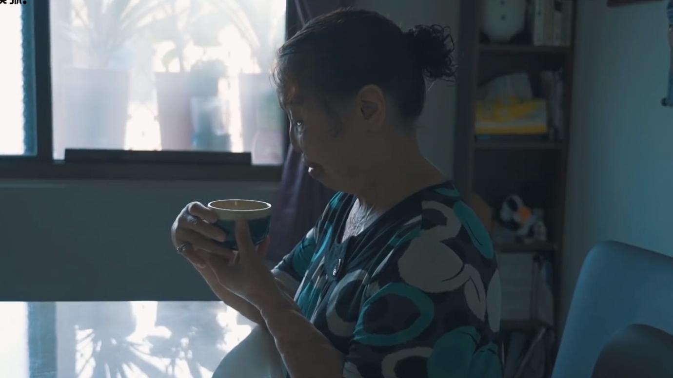 20岁小伙被重度烧伤七年后续,20岁严重烧伤毁容