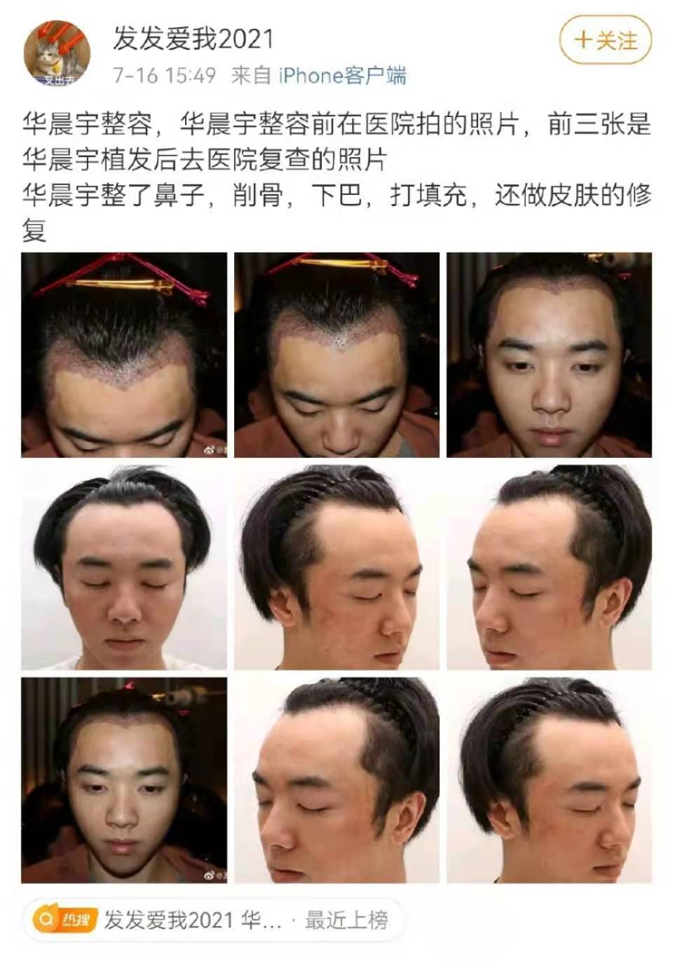 华晨宇与张碧晨最早绯闻,华晨宇和张碧晨绯闻