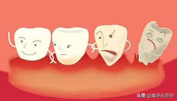牙齿矫正之后后出现黑三角怎么办？