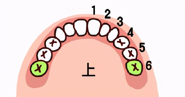 牙齿咬到硬物后牙痛可以自愈吗,咬到硬物后牙齿松动最佳补救方法