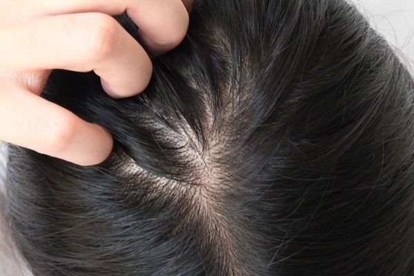 赋活头皮洗护系列,三谷头皮养护洗发水测评