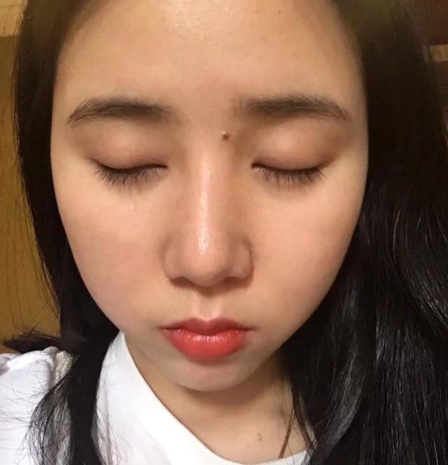 女人脸上长黑痣分析图,女人印堂有黑痣异性缘好不好