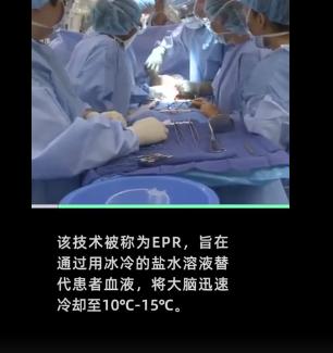 首例“假死”技术实现了？“死而复生”竟是这样......