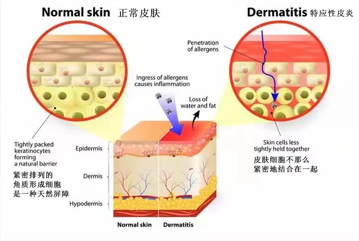 一坨痒痒的小疙瘩,咯吱窝一片一片的红疙瘩很痒