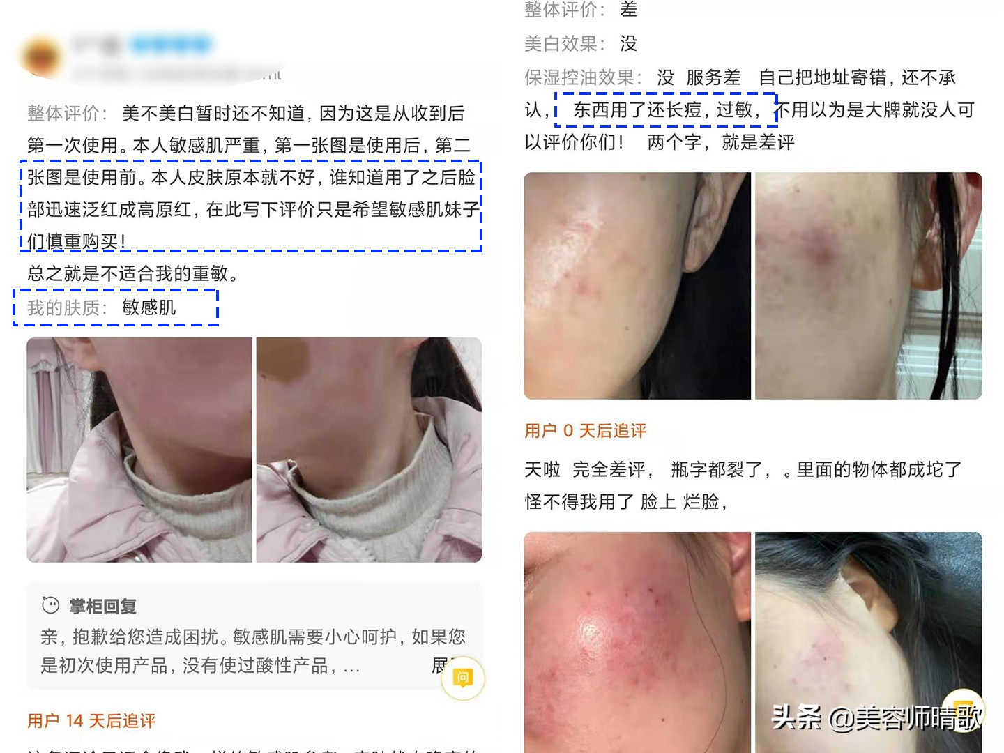 olay淡斑小白瓶3代拔草,倩碧镭射淡斑精华拔草