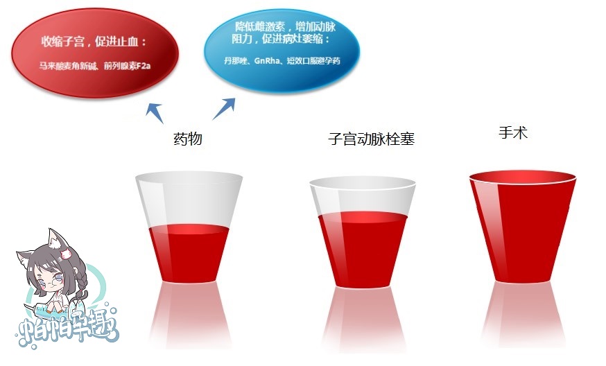 流产导致的动静脉瘘能治愈吗,流产不干净形成血管瘘