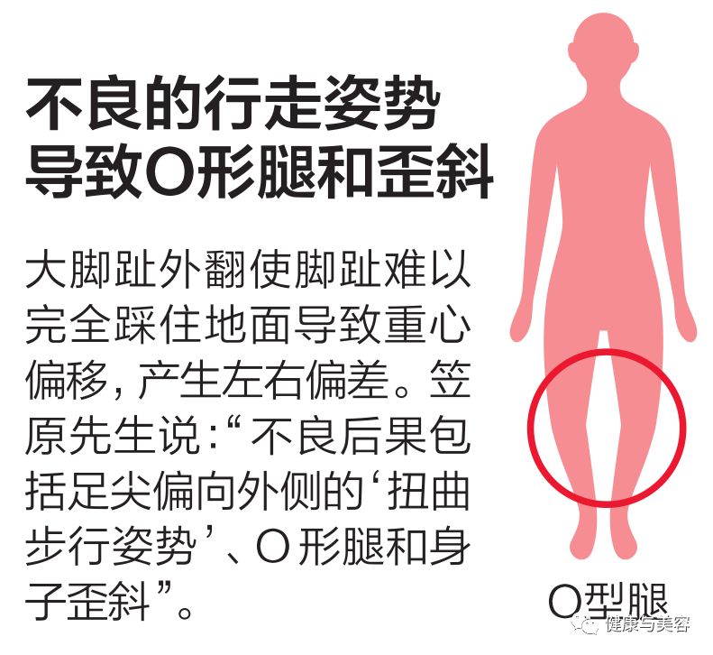 黄晓明谈身高被攻击,黄晓明的脚是如何康复的