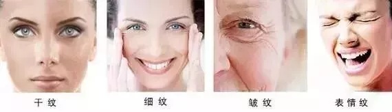 有眼纹了怎么办,30岁有眼袋眼纹很显老的感觉