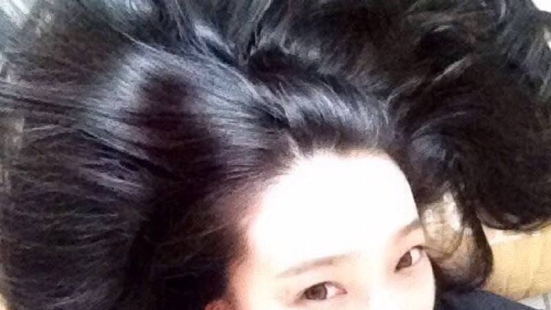 如何拯救产后脱发看下这四招,脱发食疗与用药怎样防止脱发加重