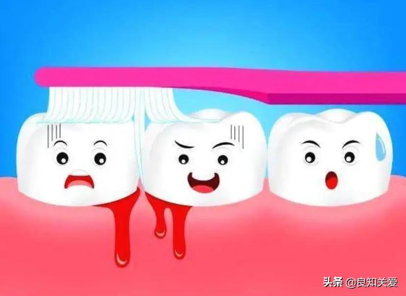 手术后牙龈出血是什么原因,牙龈出血是吃阿司匹林导致的吗