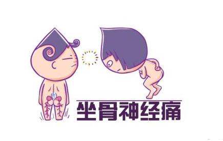 坐骨神经痛锻炼体操,坐骨神经怕站还是怕坐