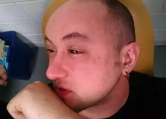 美国黑科技眼药水,美国研制的近视眼药水