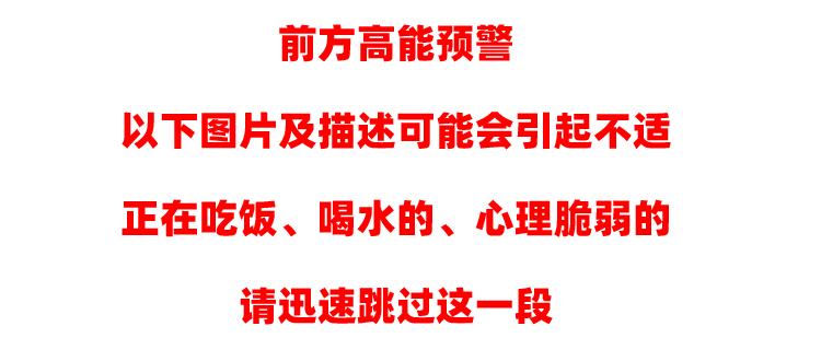 奥利司他排出油但不瘦,奥利司他胶囊怎么排出脂肪
